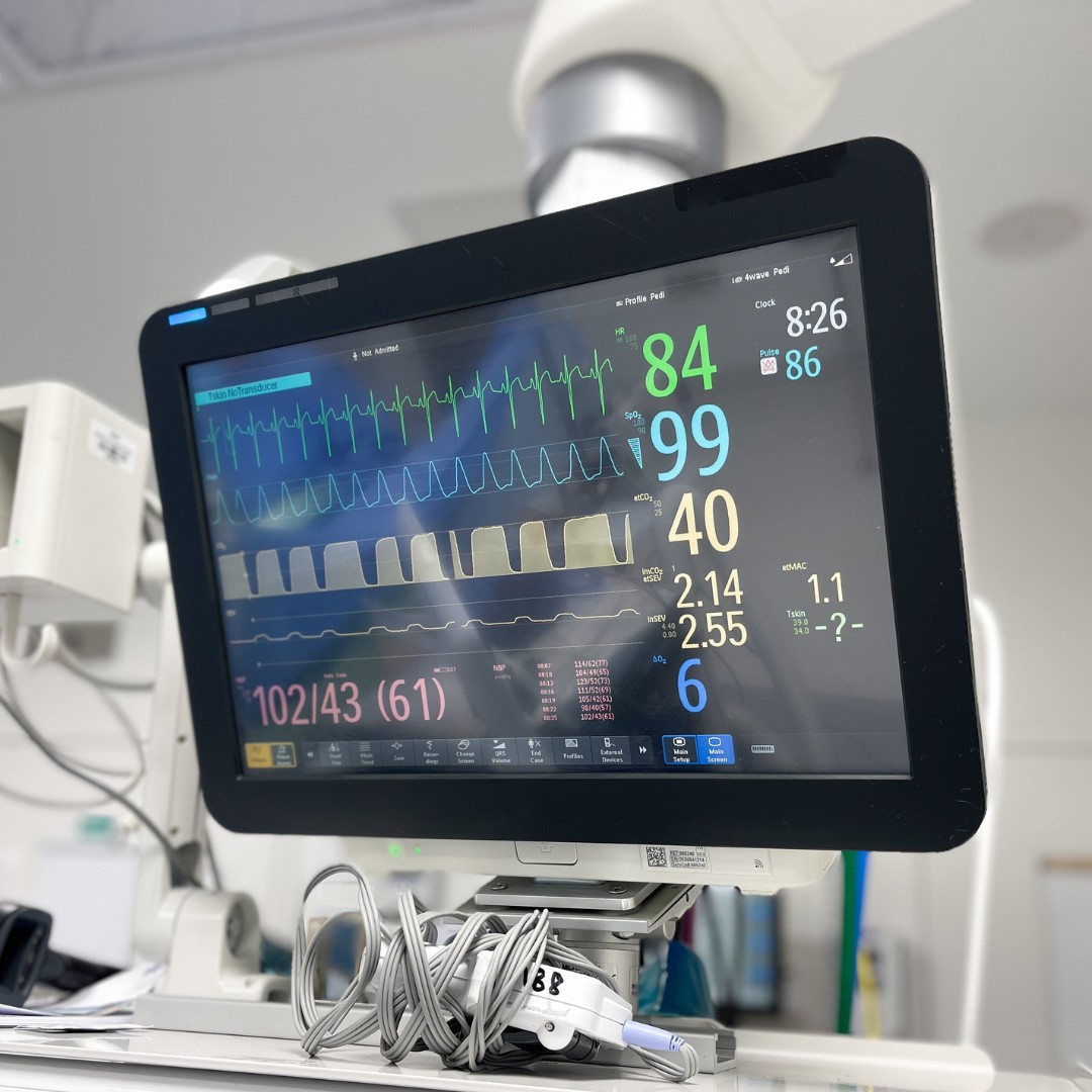 anesthesa monitor